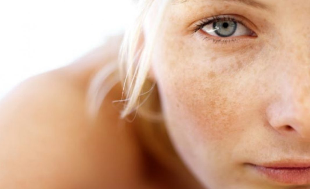 Vitiligo, Psoríase e Demais Doenças de Pele – o corpo fala
