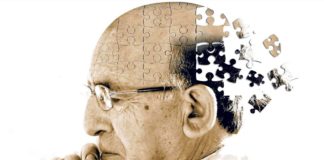 10 sinais de alerta sobre a Doença de Alzheimer