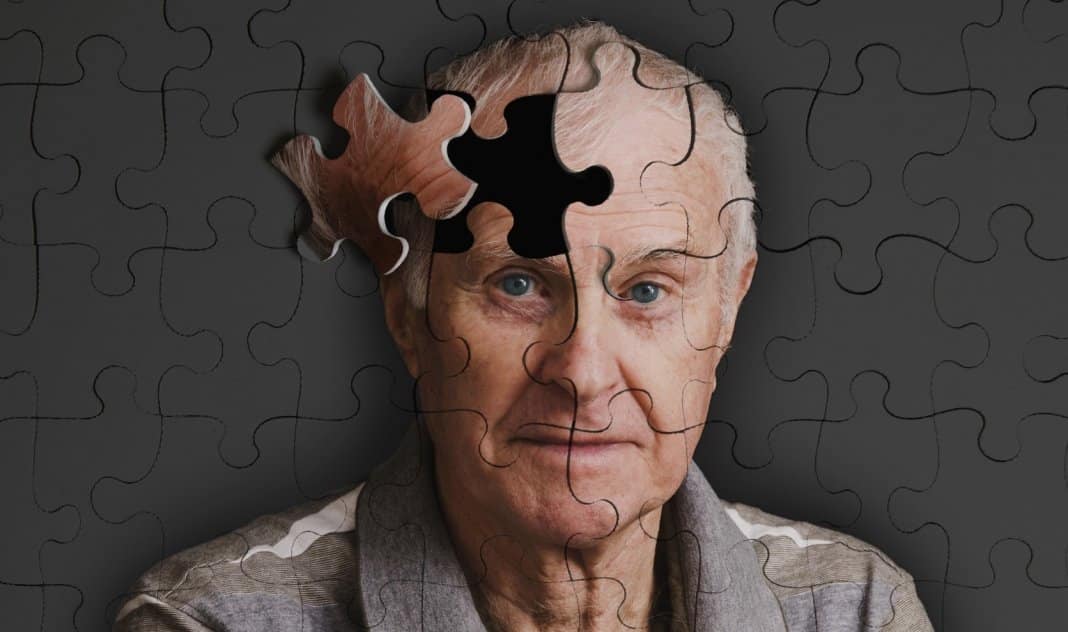 Esquecimentos podem ser sinal de Comprometimento Cognitivo Leve
