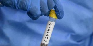 Remédio de piolho pode matar o novo coronavírus em 48 horas, diz estudo